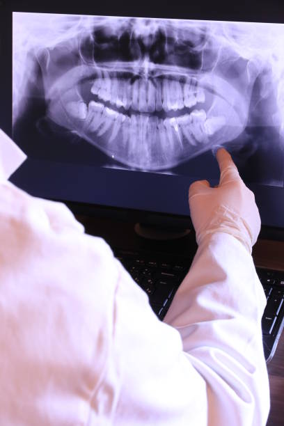 Best Emergency Dentist for Lost Fillings or Crowns in Daingerfield, TX